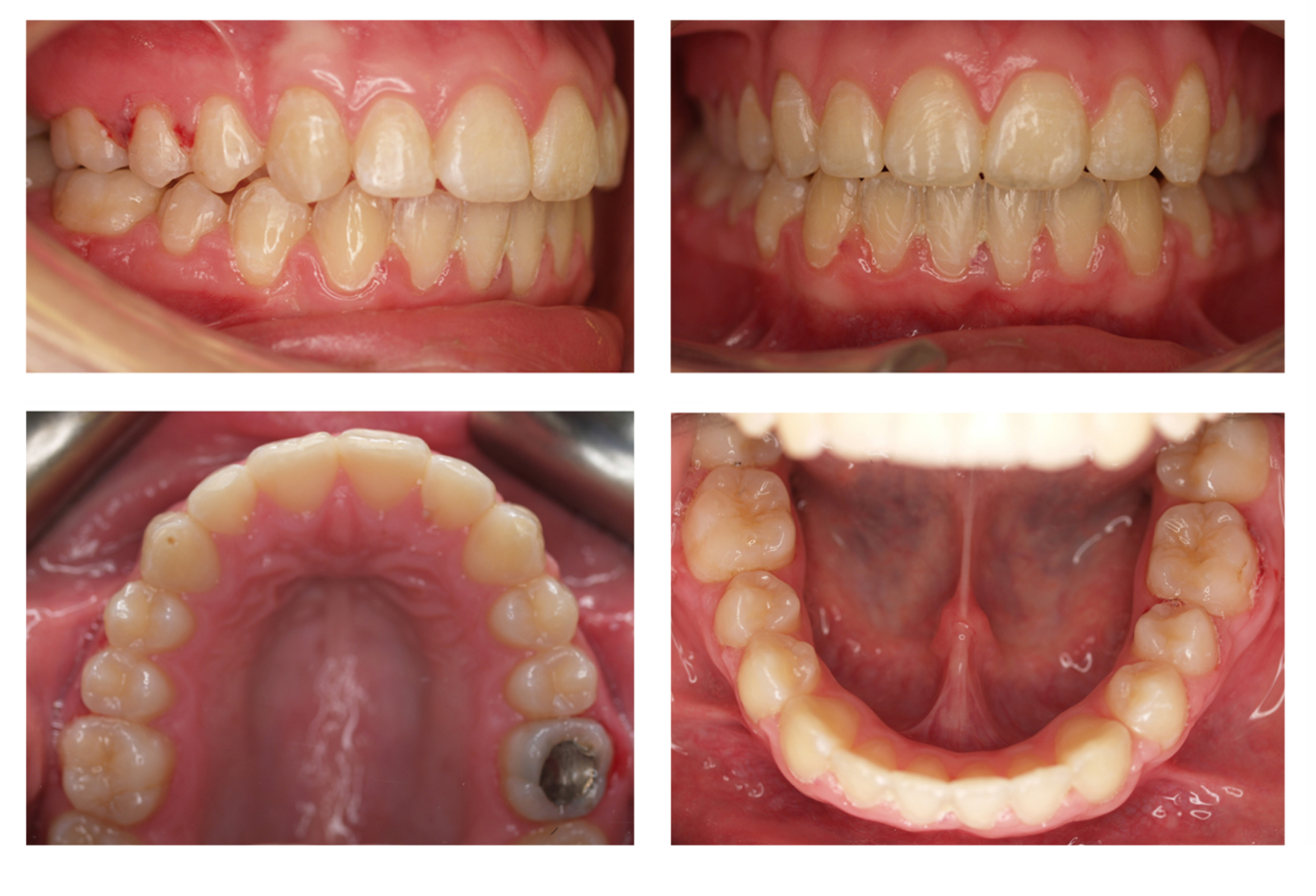 Before And After